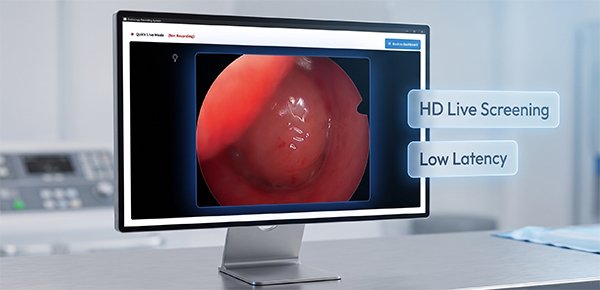 Live Endoscopy Capture